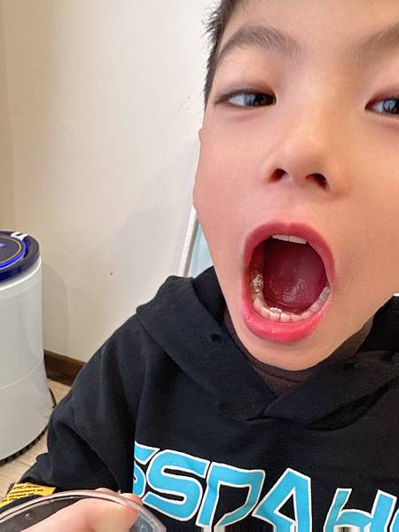 ✨極鮮高濃度魚油-來自挪威的頂級新鮮魚油🐟✨✅提供人體黃金比例 → EPA：DHA = 3：2，SGS檢驗 Omega-3 含量高達94%，業界最低氧化指標✅天然rTG型式，小分子好吸收✅榮獲4大永續認證 → 配額管理、不過度捕撈✅鋁片密封、獨立包裝，維持魚油新鮮度